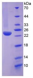 SDS-PAGE analysis of GTX00236-pro Human TNF Receptor I protein.