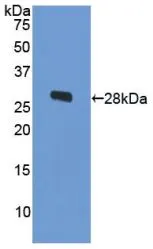 WB analysis of GTX00239-pro Human ODC protein. WB analysis of GTX00239-pro Human ODC protein.