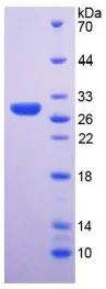 SDS-PAGE analysis of GTX00241-pro Human RPP40 protein.