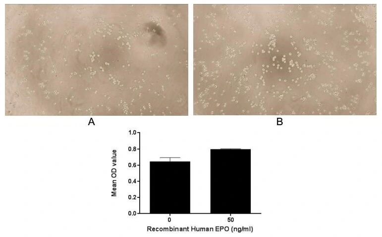 Cell proliferation effect of GTX00251-pro Human EPO protein (active). Cell viability was measured by Cell Counting Kit-8 (CCK-8). (A) Unstimulated TF-1 cells cultured inRPMI-1640 for 72hrs. (B) TF-1 cells cultured in RPMI-1640, stimulated with 50 ng/ml EPO for 72hrs.