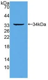 WB analysis of GTX00262-pro Human RANK protein. WB analysis of GTX00262-pro Human RANK protein.