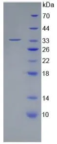 SDS-PAGE analysis of GTX00262-pro Human RANK protein.