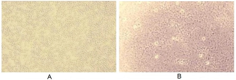 The hemagglutination effect of GTX00269-pro Human Factor B protein (active). (A) 1% rabbit erythrocyte treated with 0.3125 microg/ml CFB, 8 mmol/l EDTA without MgCl?. (B) 1% rabbit erythrocyte treated with 0.3125 microg/ml CFB , 8 mmol/l EDTA with 0.5 mmol/l MgCl? for 1hr.