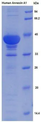 SDS-PAGE analysis of GTX00274-pro Human Annexin A1 protein.