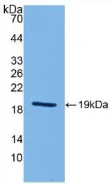 WB analysis of GTX00284-pro Mouse IL18 protein (active). WB analysis of GTX00284-pro Mouse IL18 protein (active).