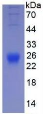 SDS-PAGE analysis of GTX00285-pro Mouse IL2 protein (active).