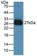 WB analysis of GTX00286-pro Mouse IL6 protein (active). WB analysis of GTX00286-pro Mouse IL6 protein (active).