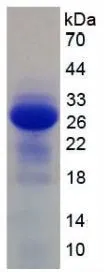 SDS-PAGE analysis of GTX00290-pro Mouse IL2 Receptor beta protein.