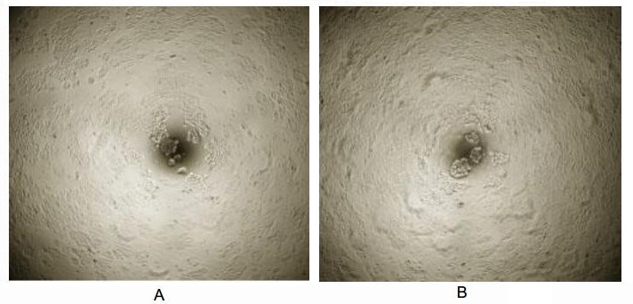 Cell proliferation effect of GTX00291-pro Mouse Insulin protein (active).<br>(A) Unstimulated MCF-7 cells cultured in DMEM for 72hrs.<br>(B) MCF-7 cells cultured in DMEM, stimulated with 100 ng/ml INS for 72hrs.