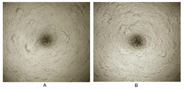 Cell proliferation effect of GTX00296-pro Mouse BMP7 protein (active).<br>(A) Unstimulated MDA-MB-231 cells cultured in DMEM for 72hrs.<br>(B) MCF-7 cells cultured in DMEM, stimulated with 10 ng/ml BMP7 for 72hrs.