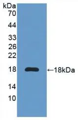 WB analysis of GTX00297-pro Mouse IL6 Receptor protein. WB analysis of GTX00297-pro Mouse IL6 Receptor protein.