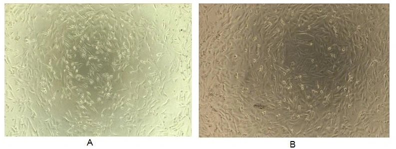 Cell proliferation effect of GTX00307-pro Mouse Reg3B protein (active). (A) Unstimulated SK-N-SH cells cultured in serum-free DMEM for 72hrs. (B) SK-N-SH cells cultured in DMEM, stimulated with 10 ng/ml REG3b 72hrs.