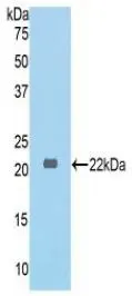 WB analysis of GTX00316-pro Mouse COL6A1 protein. WB analysis of GTX00316-pro Mouse COL6A1 protein.