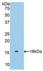 WB analysis of GTX00317-pro Mouse COL6A1 protein. WB analysis of GTX00317-pro Mouse COL6A1 protein.