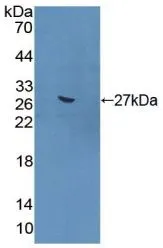 WB analysis of GTX00318-pro Mouse Gremlin 1 protein (active). WB analysis of GTX00318-pro Mouse Gremlin 1 protein (active).