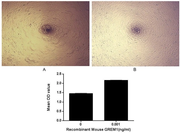 Cell proliferation effect of GTX00318-pro Mouse Gremlin 1 protein (active). Cell viability was measured by Cell Counting Kit-8 (CCK-8). (A) Unstimulated A549 cells cultured in DMEM for 96hrs. (B) A549 cells cultured in DMEM, stimulated with 1 ng/ml GREM1 for 96hrs.