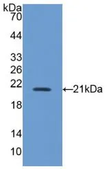 WB analysis of GTX00325-pro Mouse iNOS protein. WB analysis of GTX00325-pro Mouse iNOS protein.