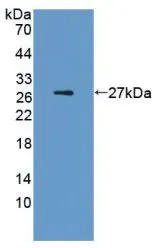 WB analysis of GTX00341-pro Rat IL6 protein (active). WB analysis of GTX00341-pro Rat IL6 protein (active).