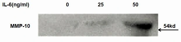 ELISA detection of secreted MMP10 protein activation from A549 cells induced by GTX00341-pro Rat IL6 protein (active) for 24hrs. Recombinant protein concentrations: 25, and 50 ng/ml.