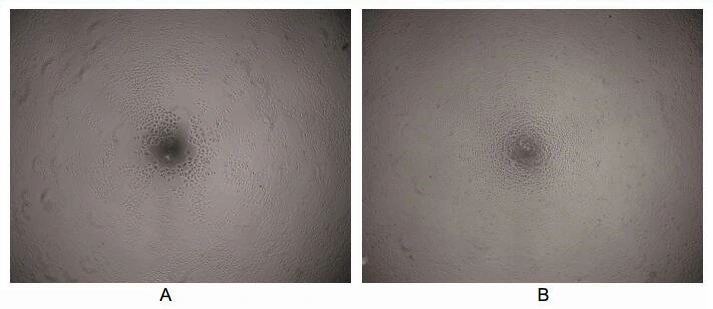 Cell proliferation effect of GTX00343-pro Rat VEGFA protein (active). (A) Unstimulated ECV-304 cells cultured in serum-free DMEM for 72hrs. (B) ECV-304 cells cultured in serum-free DMEM, stimulated with 10 ng/ml VEGFA for 72hrs.