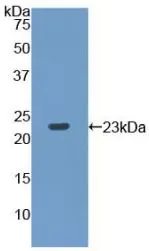 WB analysis of GTX00344-pro Rat RPP40 protein. WB analysis of GTX00344-pro Rat RPP40 protein.