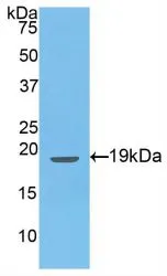 WB analysis of GTX00345-pro Rat Endothelin 1 protein (active). WB analysis of GTX00345-pro Rat Endothelin 1 protein (active).
