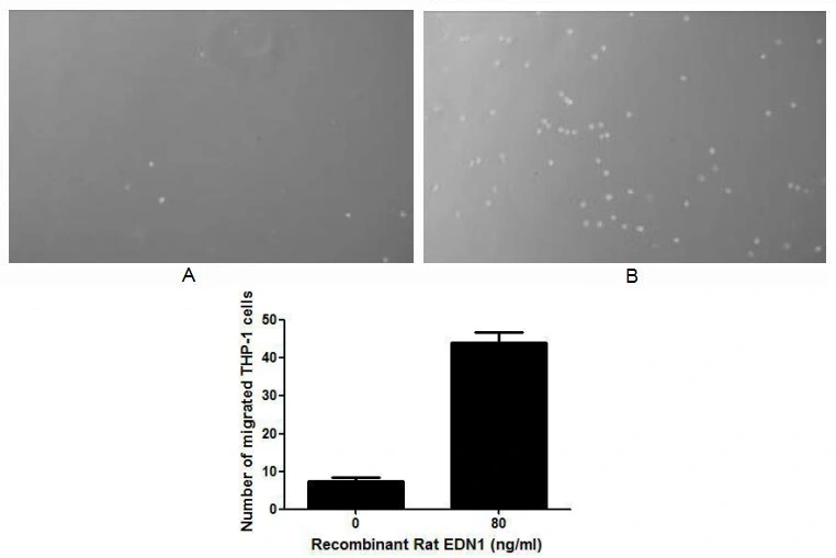 The chemotactic effect of GTX00345-pro Rat Endothelin 1 protein (active). Upper: (A) THP-1 cells were seeded into the upper chambers and serum free RPMI-1640 without EDN1 was added in lower chamber, then cells in lower chamber were observed at low magnification (x100) after incubation for 3hrs. (B) THP-1 cells were seeded into the upper chambers and serum free RPMI-1640 with 80 ng/ml EDN1 was added in lower chamber, then cells in lower chamber were observed at low magnification (x100) after incubation for 3hrs. Lower: The number of migrated cells were counted at high magnification (x400) randomly (five fields for each filter).