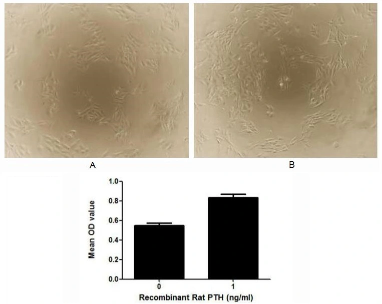 Cell proliferation effect of GTX00348-pro Rat Parathyroid Hormone protein (active). Cell viability was measured by Cell Counting Kit-8 (CCK-8). (A) Unstimulated U2OS cells cultured in DMEM for 48hrs. (B) U2OS cells cultured in DMEM, stimulated with 1 ng/ml PTH for 48hrs.