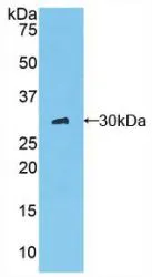 WB analysis of GTX00353-pro Rat CTRC protein. WB analysis of GTX00353-pro Rat CTRC protein.
