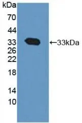 WB analysis of GTX00357-pro Rat Calpain 1 protein. WB analysis of GTX00357-pro Rat Calpain 1 protein.
