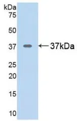 WB analysis of GTX00359-pro Rat Arginase 1 protein. WB analysis of GTX00359-pro Rat Arginase 1 protein.