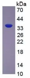 SDS-PAGE analysis of GTX00359-pro Rat Arginase 1 protein.