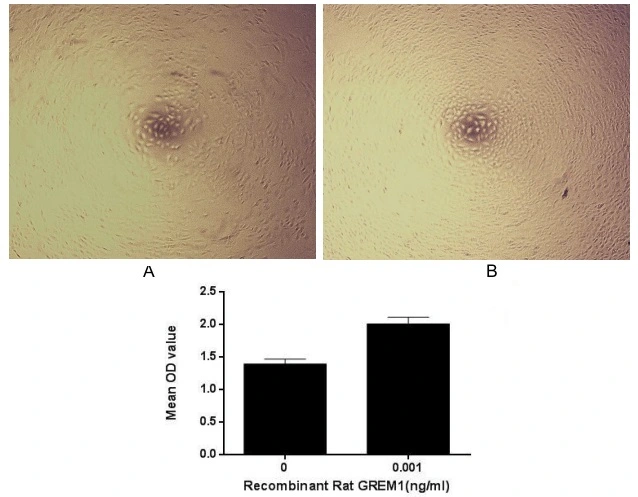Cell proliferation effect of GTX00362-pro Rat Gremlin 1 protein (active). Cell viability was measured by Cell Counting Kit-8 (CCK-8). (A) Unstimulated A549 cells cultured in DMEM for 96hrs. (B) A549 cells cultured in DMEM, stimulated with 1 ng/ml GREM1 for 96hrs.