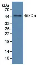 WB analysis of GTX00365-pro Rat GM-CSF protein. WB analysis of GTX00365-pro Rat GM-CSF protein.