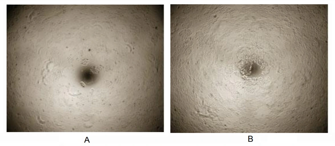 Cell proliferation effect of GTX00417-pro Human Neuregulin-1 protein (active). (A) Unstimulated MCF-7 cells cultured in DMEM for 72hrs. (B) MCF-7 cells cultured in DMEM, stimulated with 10 ng/ml NRG1 for 72hrs. Cell proliferation effect of GTX00417-pro Human Neuregulin-1 protein (active). (A) Unstimulated MCF-7 cells cultured in DMEM for 72hrs. (B) MCF-7 cells cultured in DMEM, stimulated with 10 ng/ml NRG1 for 72hrs.