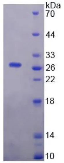 SDS-PAGE analysis of GTX00417-pro Human Neuregulin-1 protein (active).