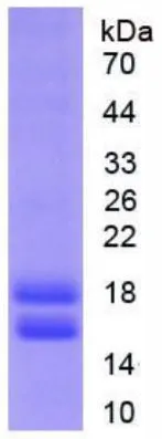 SDS-PAGE analysis of GTX00418-pro Human CYP1B1 protein.