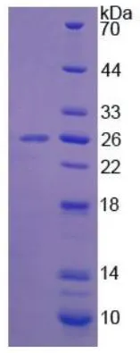 SDS-PAGE analysis of GTX00423-pro Mouse SOD3 protein.