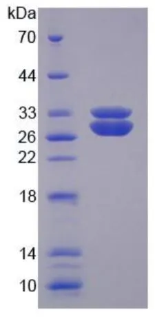 SDS-PAGE analysis of GTX00425-pro Human SOD3 protein.