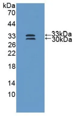 WB analysis of GTX00425-pro Human SOD3 protein.