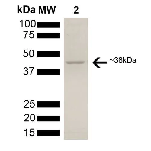 SDS-PAGE analysis of GTX00427-pro Human AHA-1 protein (active). SDS-PAGE analysis of GTX00427-pro Human AHA-1 protein (active).