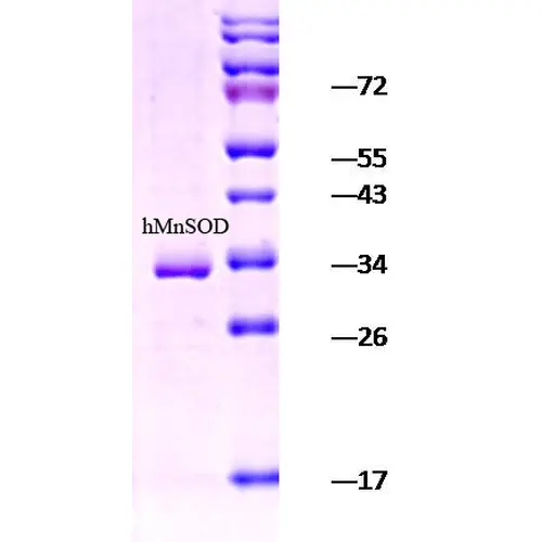 SDS-PAGE analysis of GTX00444-pro Human SOD2 protein. SDS-PAGE analysis of GTX00444-pro Human SOD2 protein.