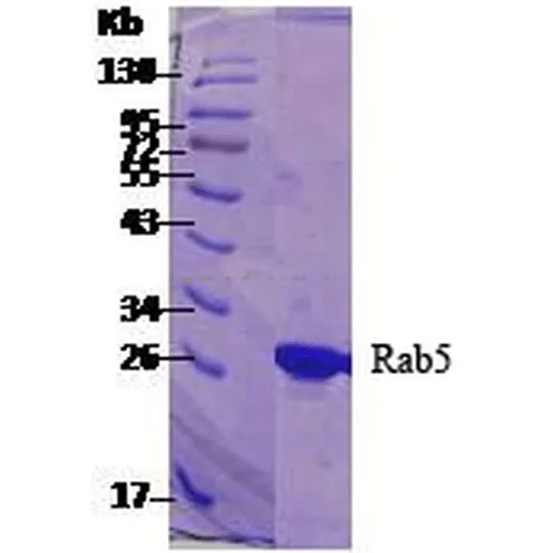 SDS-PAGE analysis of GTX00450-pro Human RAB5A protein. SDS-PAGE analysis of GTX00450-pro Human RAB5A protein.