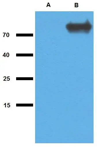 WB analysis of (A) non-transfected and (B) GlcB-transfected E. coli using GTX00496 Mycobacterium tuberculosis GlcB antibody [PAb (192)].