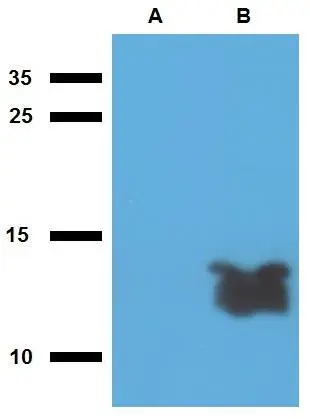 WB analysis of (A) non-transfected and (B) Tb7.7-transfected E. coli using GTX00497 Mycobacterium tuberculosis Tb7.7 antibody [PAb (190)].