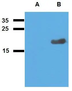 WB analysis of (A) non-transfected and (B) Acr2-transfected E. coli using GTX00498 Mycobacterium tuberculosis Acr2 antibody [PAb (188)].