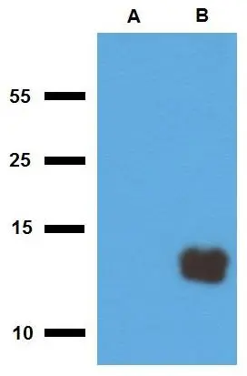 WB analysis of (A) non-transfected and (B) Tb10.3-transfected E. coli using GTX00499 Mycobacterium tuberculosis Tb10.3 antibody [PAb (187)].