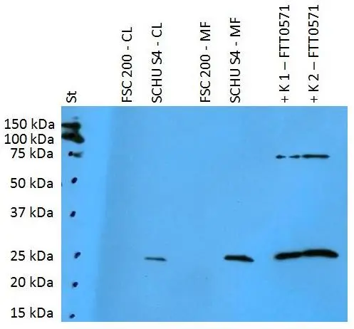 WB analysis of various samples using GTX00501 F. t. tularensis FTT0571 antibody [PAb (181)].<br>St : Mw marker <br>FSC200-CL : 10 &#956;g of FSC200 cell lysate<br>SCHUS4-CL : 10 &#956;g of SCHU S4 cell lysate<br>FSC200-MF : 10 &#956;g of FSC200 membrane fraction<br>SCHUS4-CL : 10 &#956;g of SCHU S4 membrane fraction <br>K1 : 50 ng of FTT0571 recombinant protein<br>K2 : 125 ng of FTT0571 recombinant protein