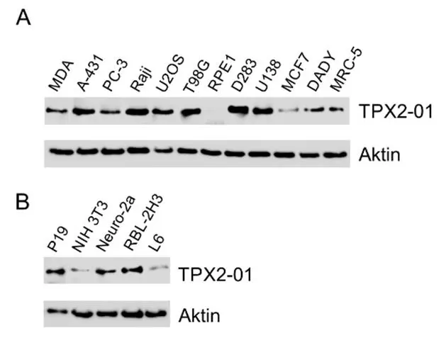 WB analysis of (A) various human, (B) mouse, (P19, NIH 3T3, Neuro-2a) and rat (RBL-2H3, L6) cell lysates using GTX00510 TPX2 antibody [TPX2-01].