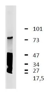 WB analysis of GARP antigen and its degradatory products in lysate of human thrombocytes using GTX00516 GARP antibody [GARP5].
